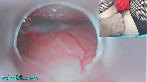 Big Uncensored Japanese Insemination with Cum into Uterus and Endoscope Camera by Cervix to watch inside womb warm Videos